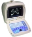 image of Medical Implement - Ultrasound Scanner