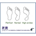 Foot Arch Support Insoles - Result of Health Drink