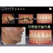 New Dental Implants - Result of Nonwoven Surgical Gown