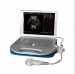 Ultrasound scanner BEU-8360A - Result of fetal doppler;doppler