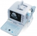 BEU-8500 Ultrasound Scanners 　　 - Result of ultrasound doppler