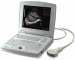 Ultrasound Scanners 　　BEU-8800 - Result of ultrasound doppler