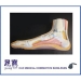 Arch Shoe Inserts - Result of Biomechanics Walk