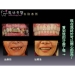 Laser Dental - Result of laser