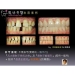 Cosmetic Dental Surgery - Result of Actuator Parts