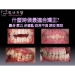 Children Dental Treatment - Result of digital photo frame