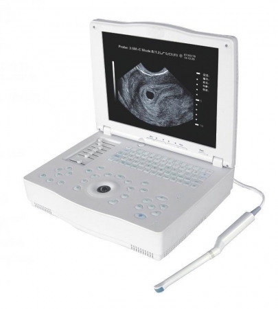 Notebook Ultrasound Scanner