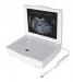 Notebook Ultrasound Scanner - Result of Lenslet Array