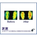 Medical Insoles Arch Support - Result of far infrared sauna