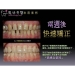 Dental Cosmetics - Result of Dental Prosthetics