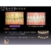 Best Tooth Whitening - Result of Dental Prosthetics